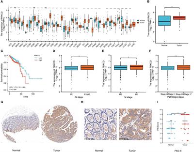 PKCδ promotes the invasion and migration of colorectal cancer through c-myc/NDRG1 pathway